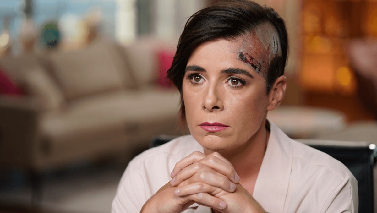 Anna Moroni, il drammatico racconto: "Operata alla testa, a un passo dal coma"